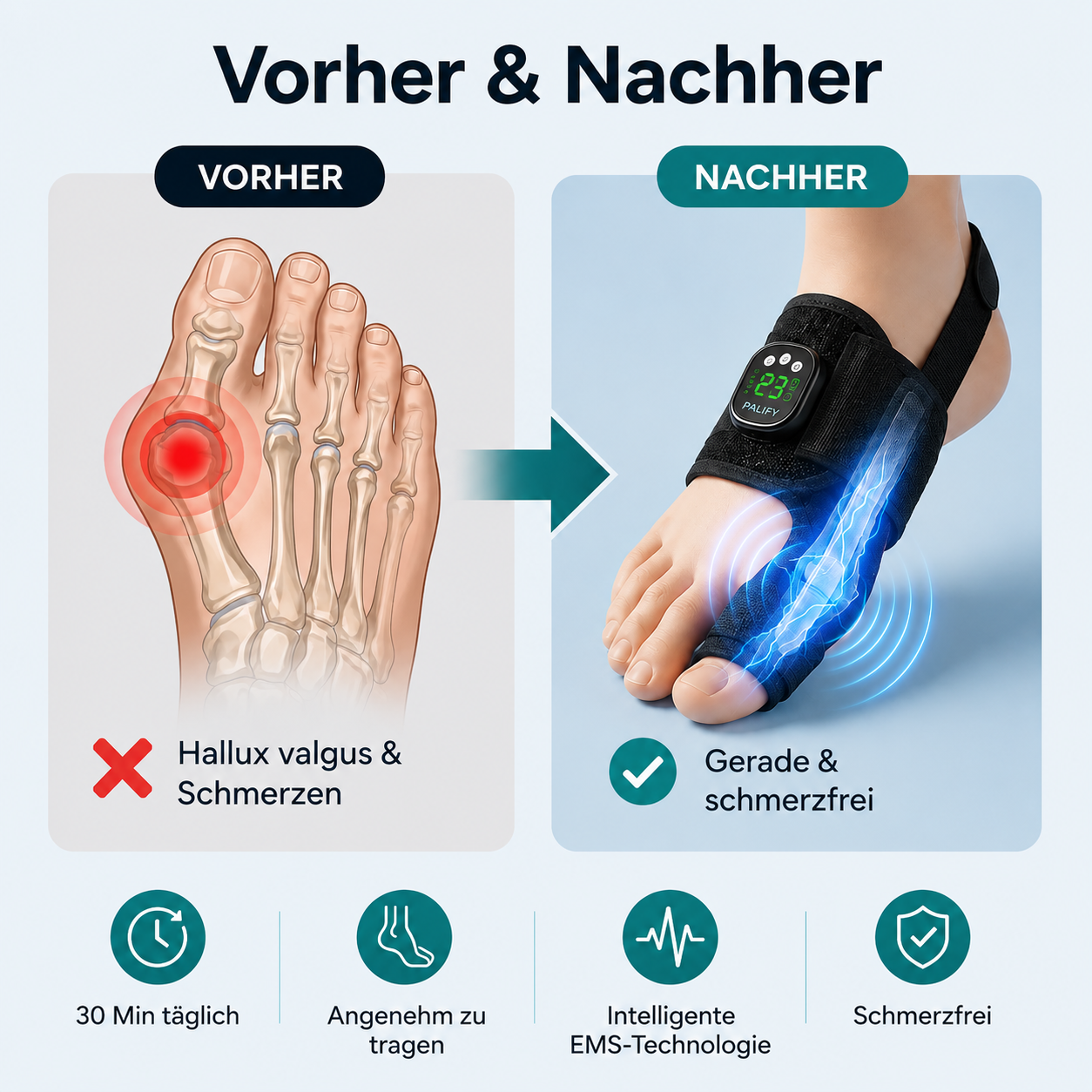 Hallux Pro™